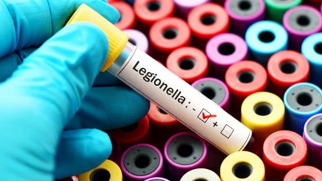 FAQs on Legionella Testing and Risk Management 3 FAQs 4